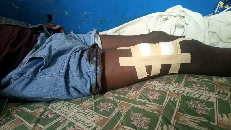 Djugu: l’un des deux négociants d’or blessés par des bandits armés est mort à Mongbwalu